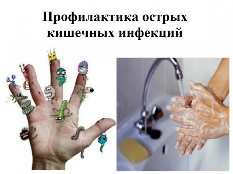 Профилактика острых кишечных инфекций. Профилактика острых кишечных инфекций.